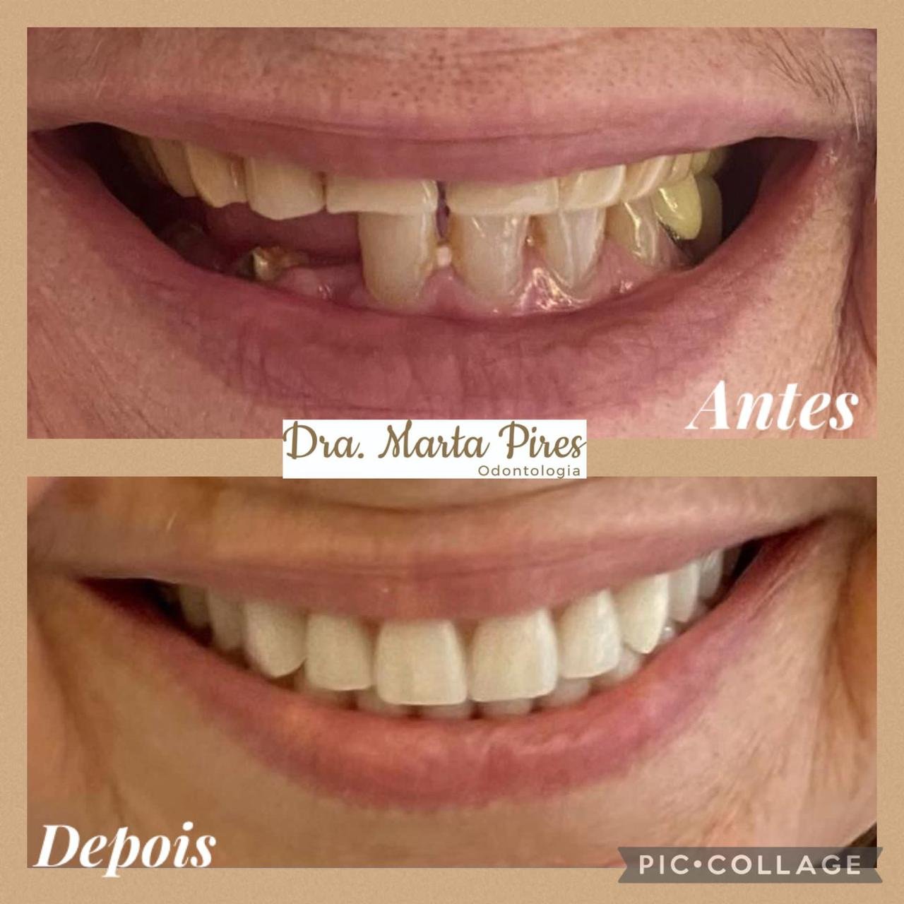 Transformação Estética