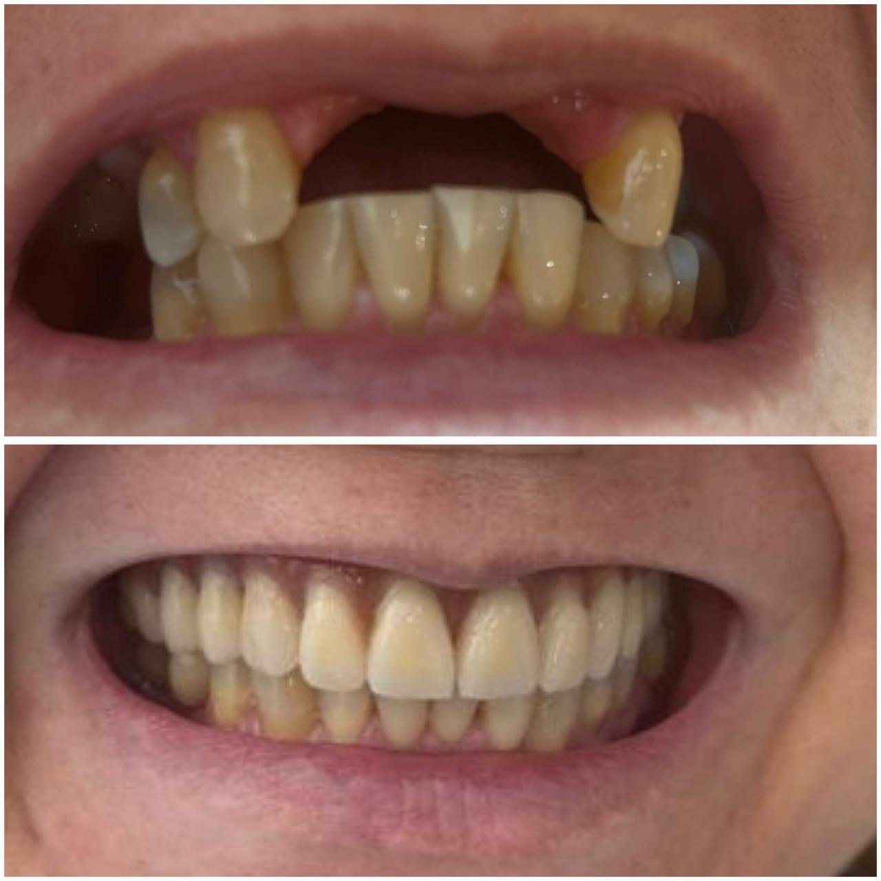 Reconstrução do Sorriso